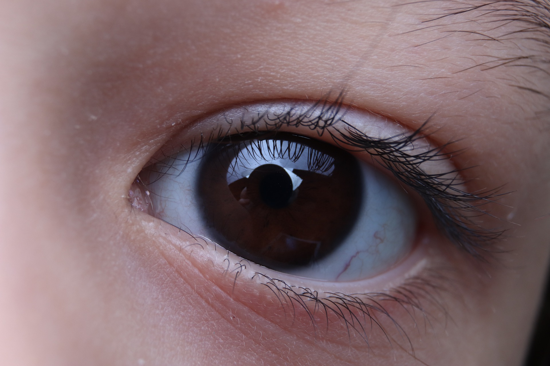 œil myope enfant